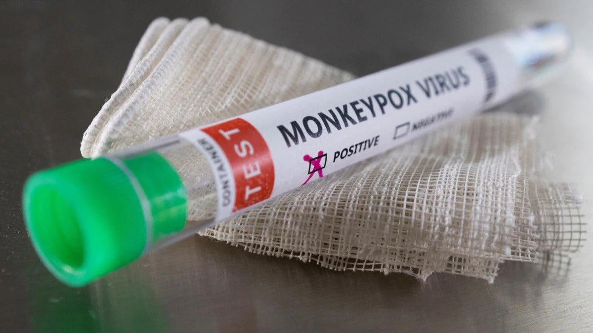 Monkeypox: Preventive Measures and Home Remedies for the Symptoms - Dr Trust