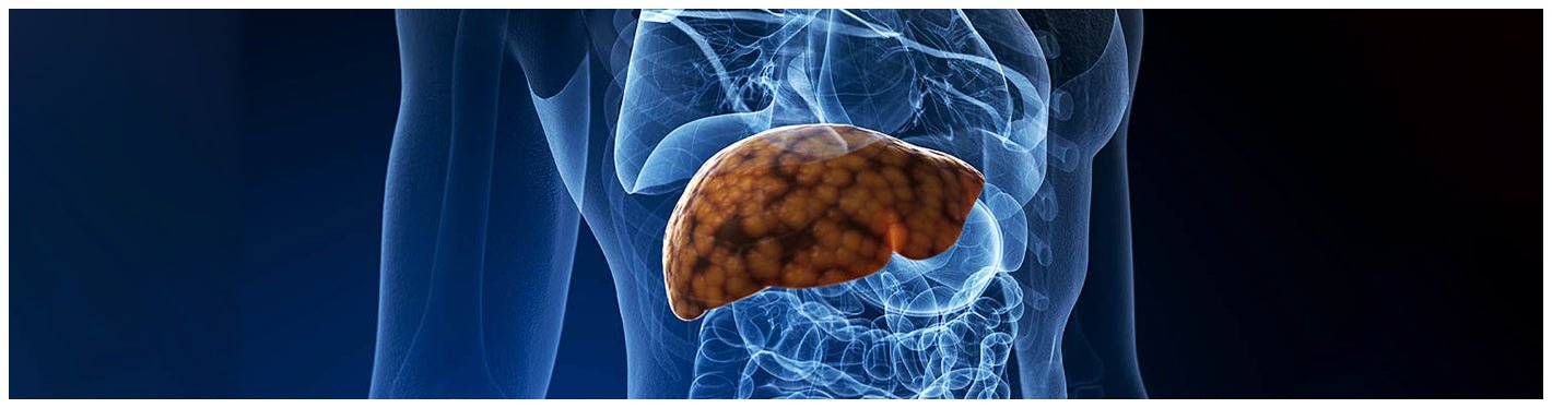 These Dietary Changes can Revert Your Fatty Liver - Dr Trust