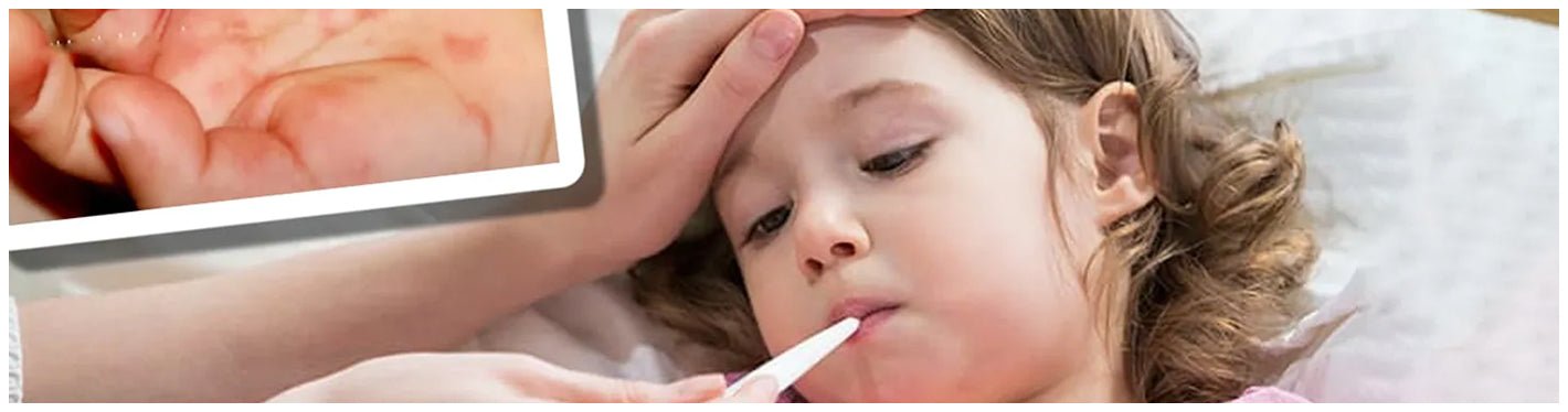 Tomato Flu: A New Virus Strain Outbreak in Children - Dr Trust
